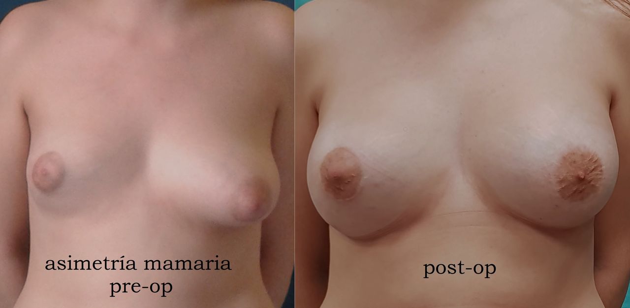 Enrique Bonanad Fernandez-3