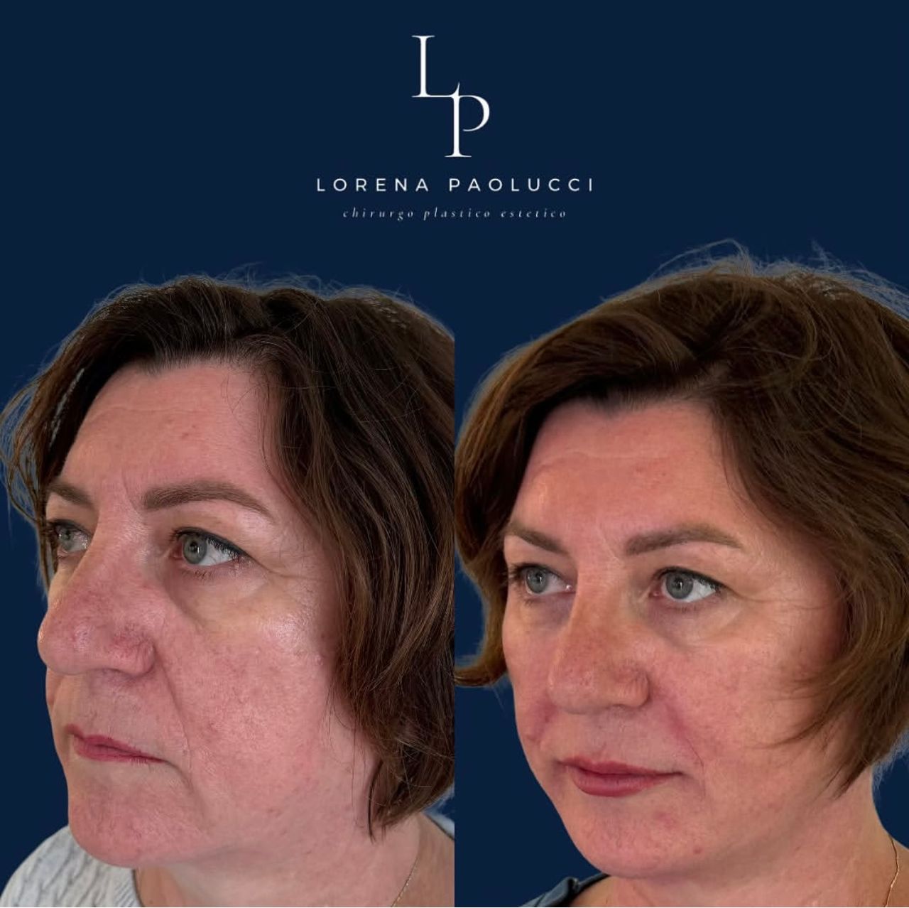 Lorena Paolucci-47