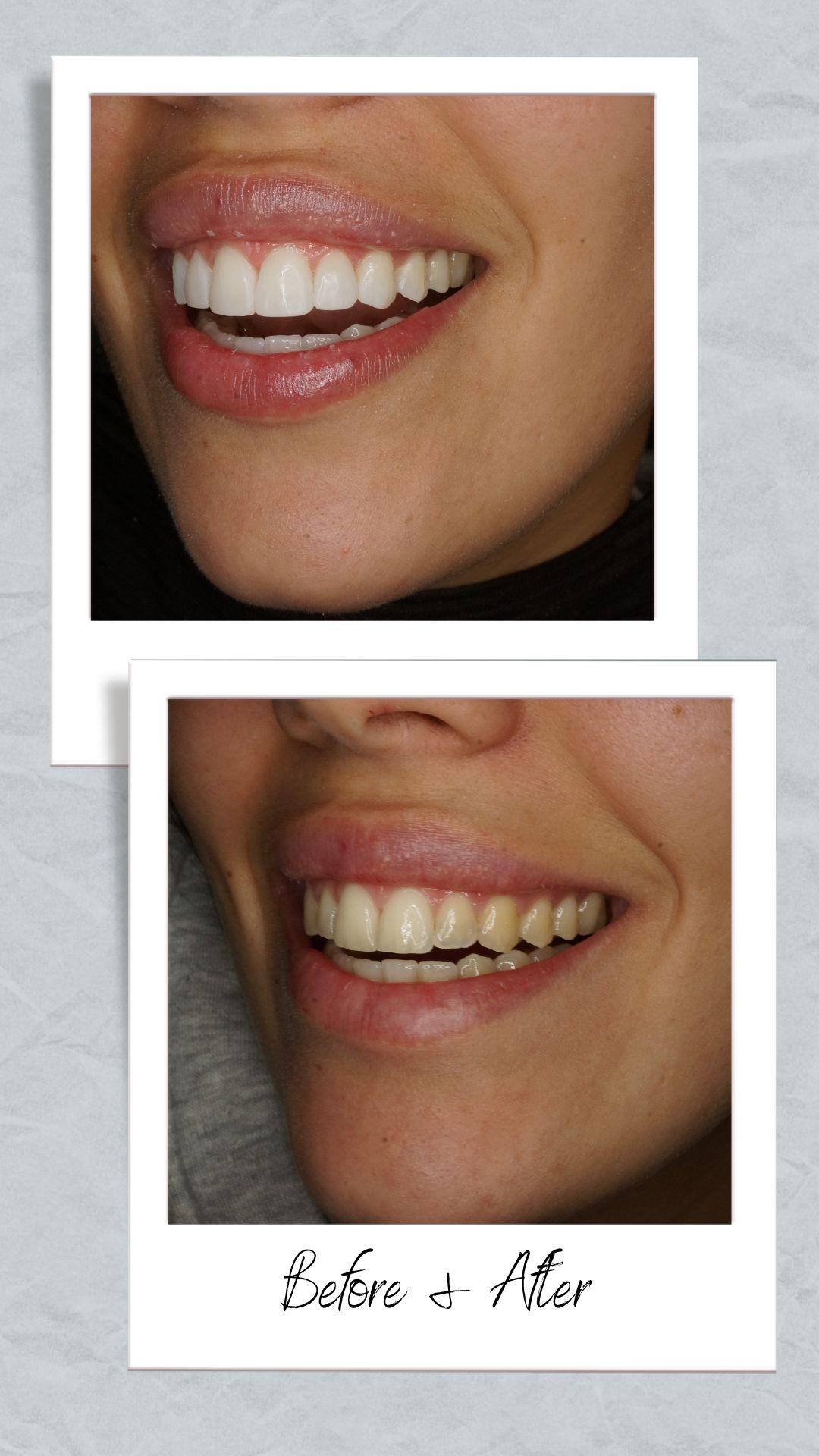 Raimonda Bogdanoviciute-20