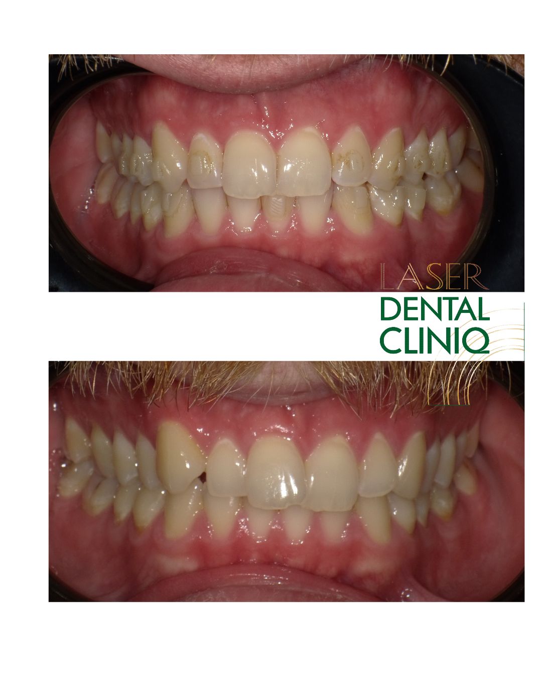 Magdalena Przybysz-36