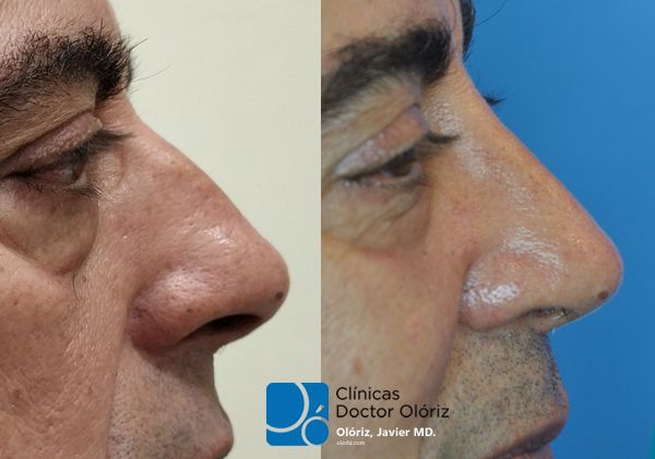 Javier Oloriz Marin-11