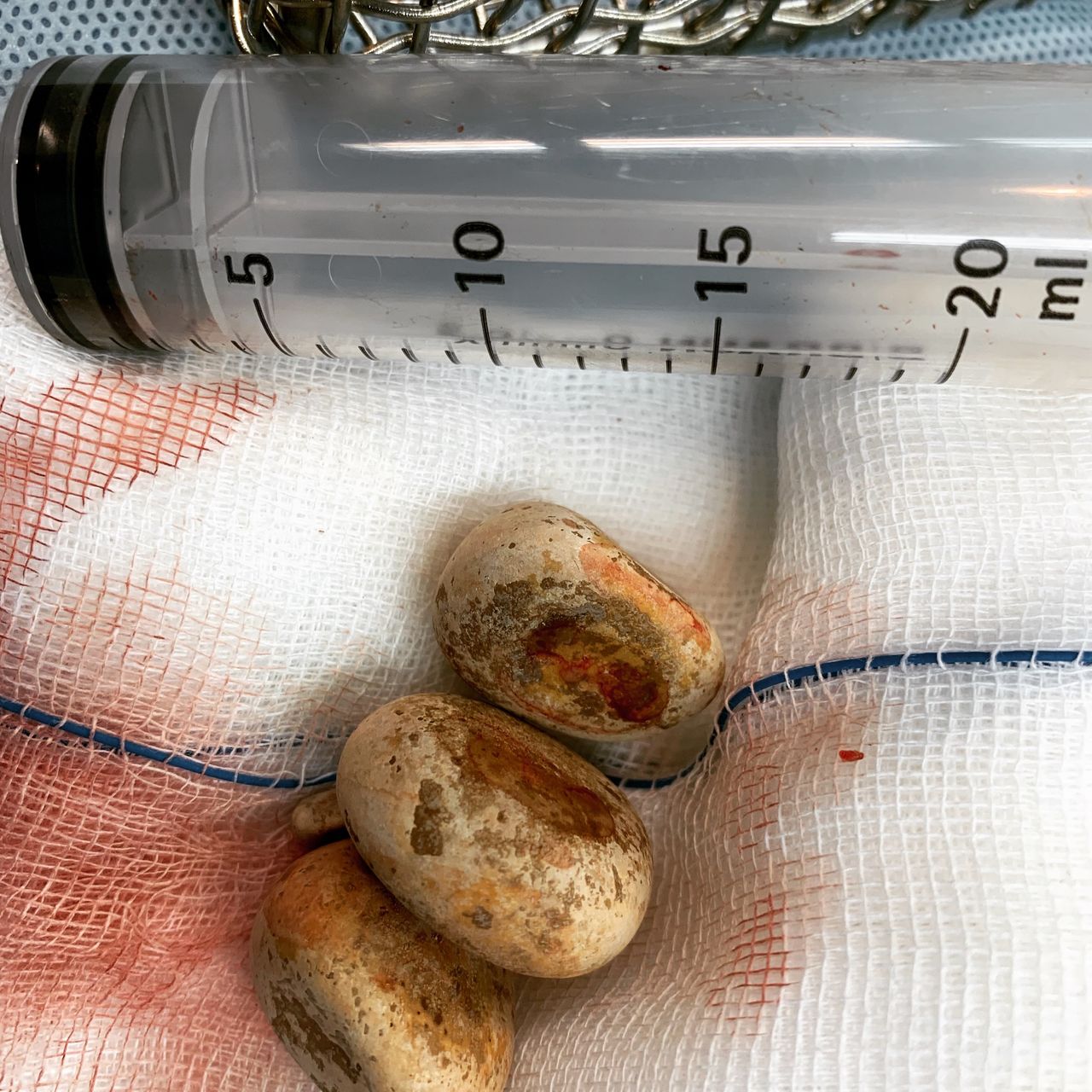 Luis Fernando Susaníbar Napurí-23