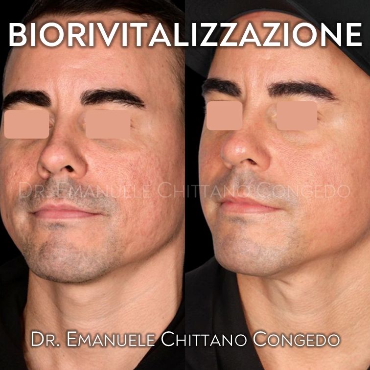 Emanuele Chittano Congedo-9