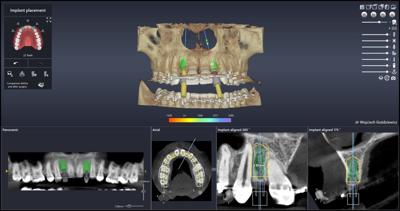 Wojciech Goździewicz-1