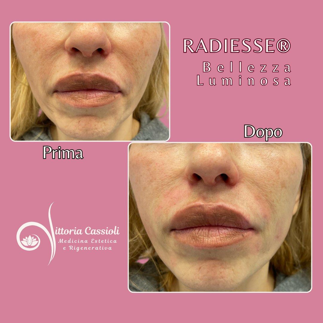 Vittoria Cassioli-39