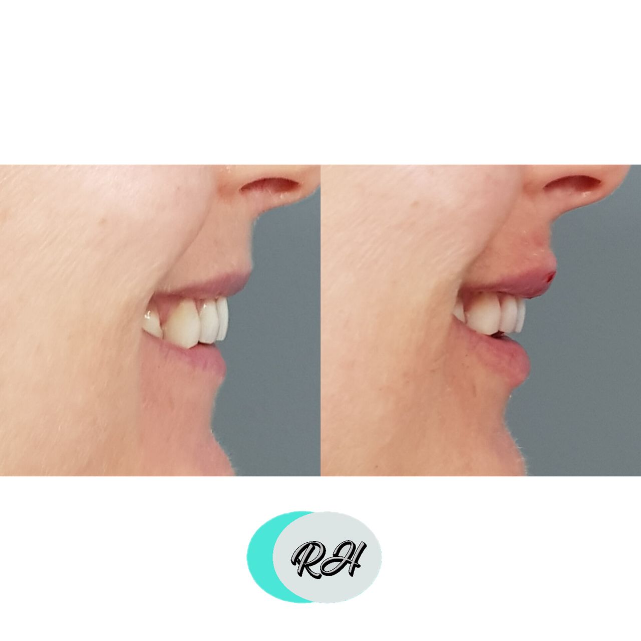 Rosalba Herrero Zerpa-137