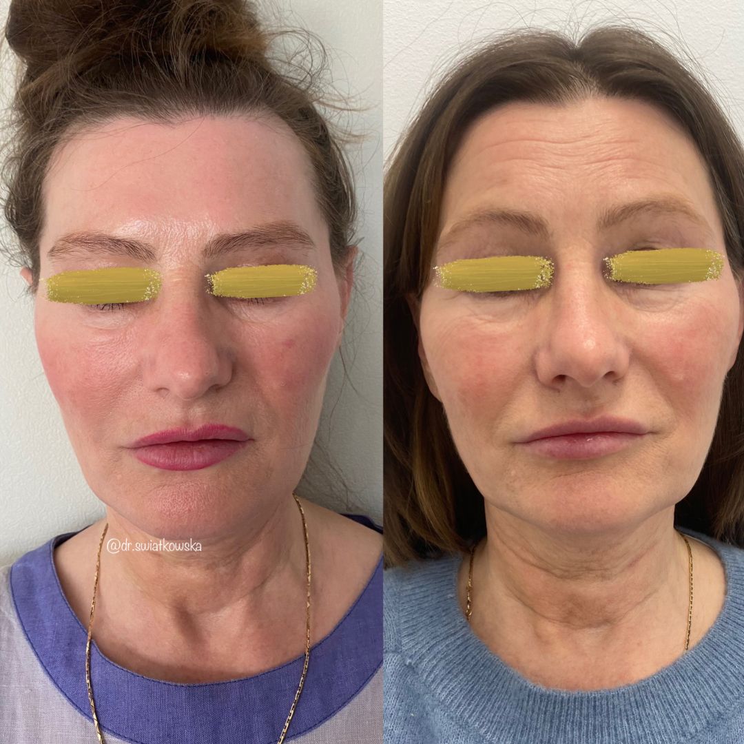 Angelika Świątkowska-37