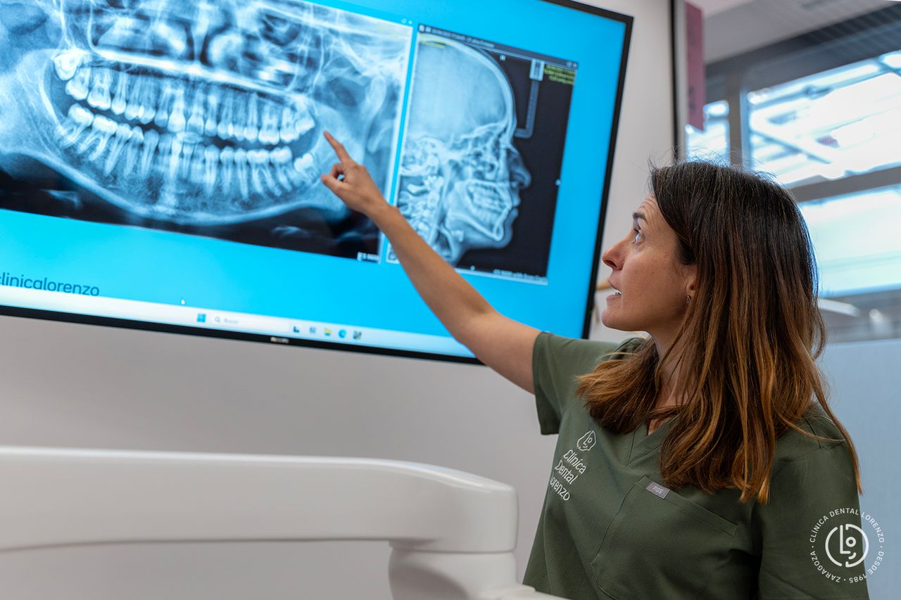 Laura Junquera Alfayate-4