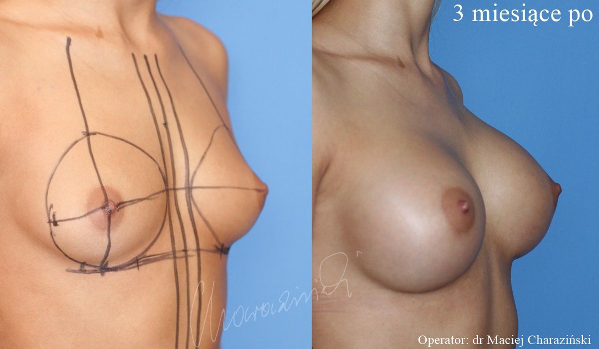 Maciej Charaziński-112