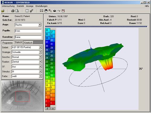 Radosław Żywalewski-4