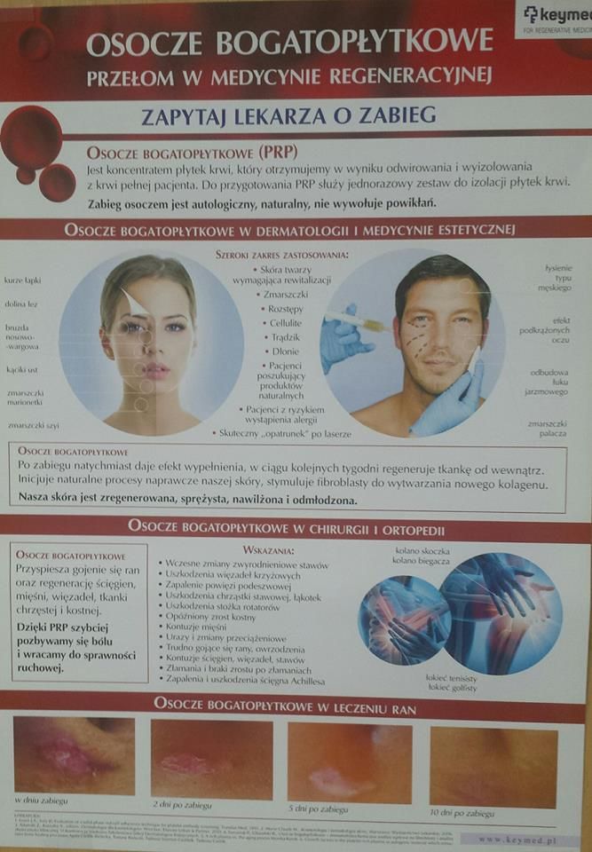 Zbigniew Pietrzak-13