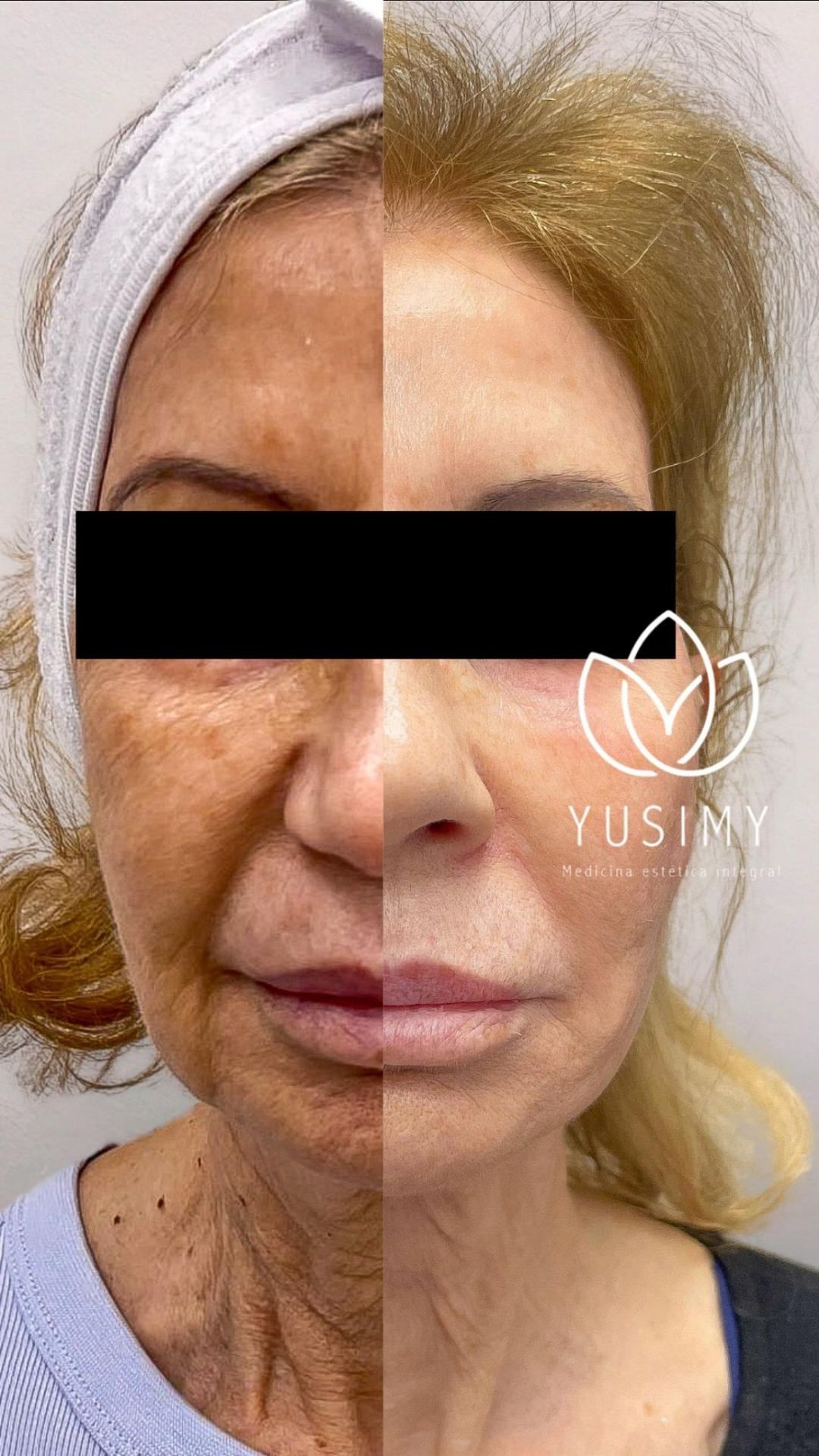 Yusimy Venereo Ramirez-3