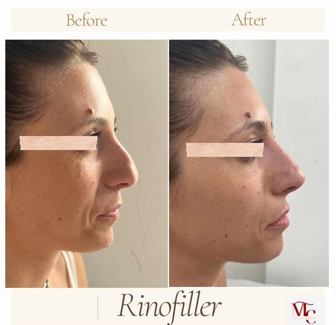 Maria Teresa Caragallo-4