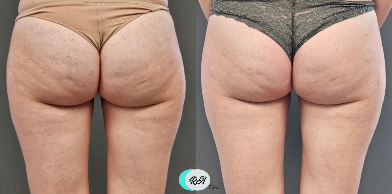 Rosalba Herrero Zerpa-546