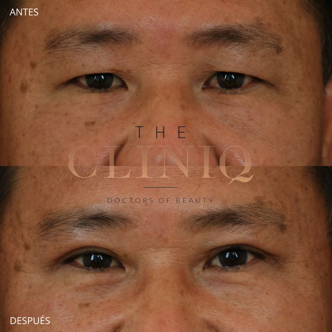 Ignacio Genol Saavedra-11