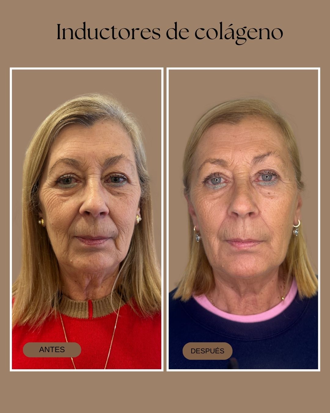 Paula Fontenla Seco-3