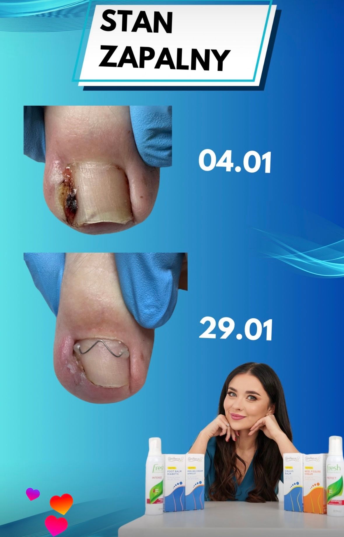 Karolina Colonna-Walewska-24