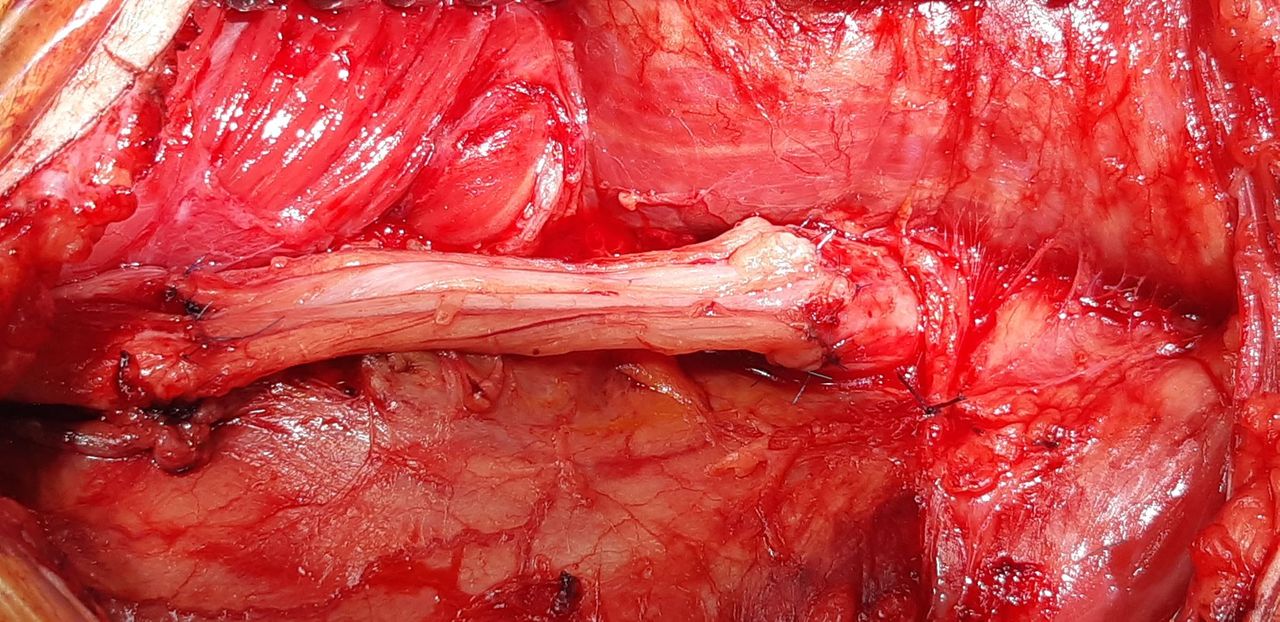 Jarosław Andrychowski-55