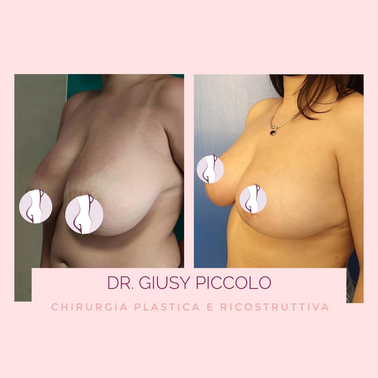 Giuseppina Piccolo-28