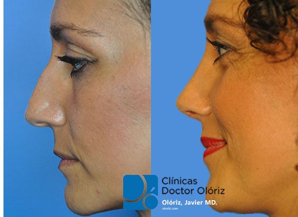 Javier Oloriz Marin-8