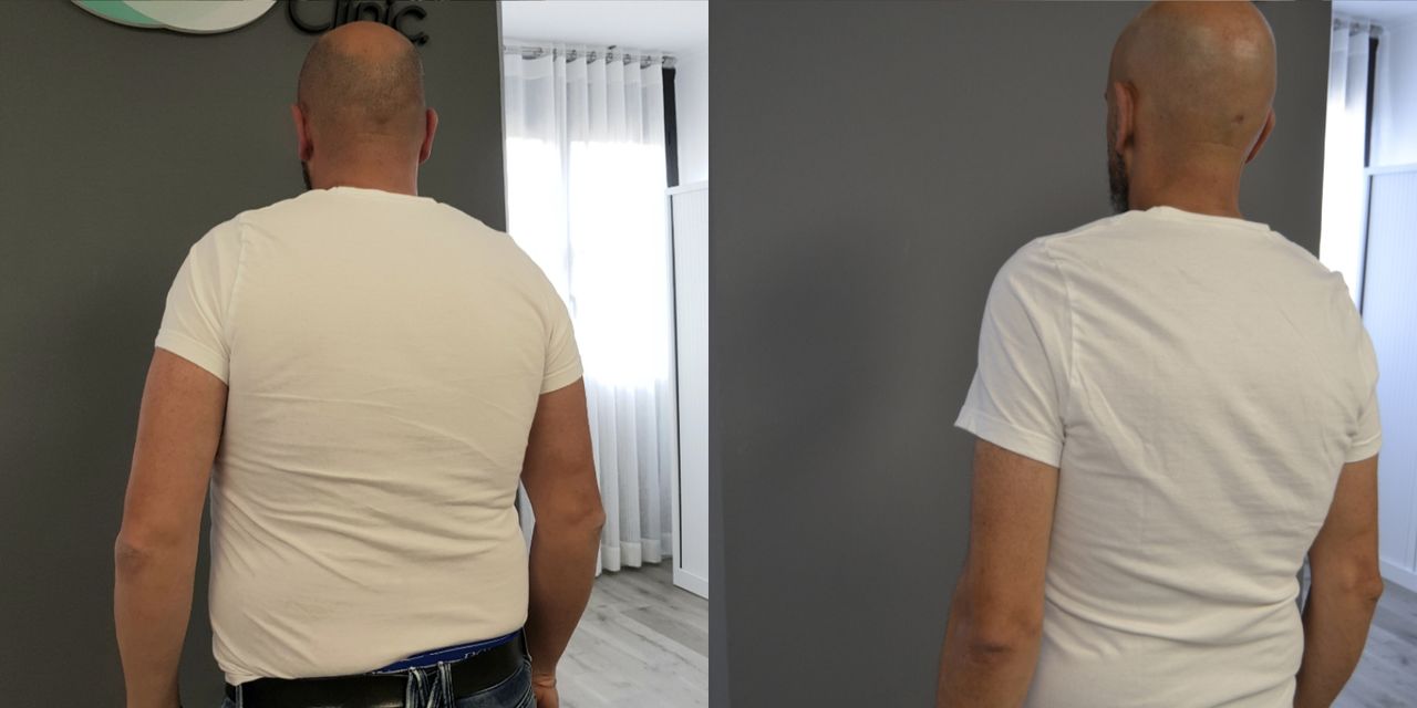 Rosalba Herrero Zerpa-170