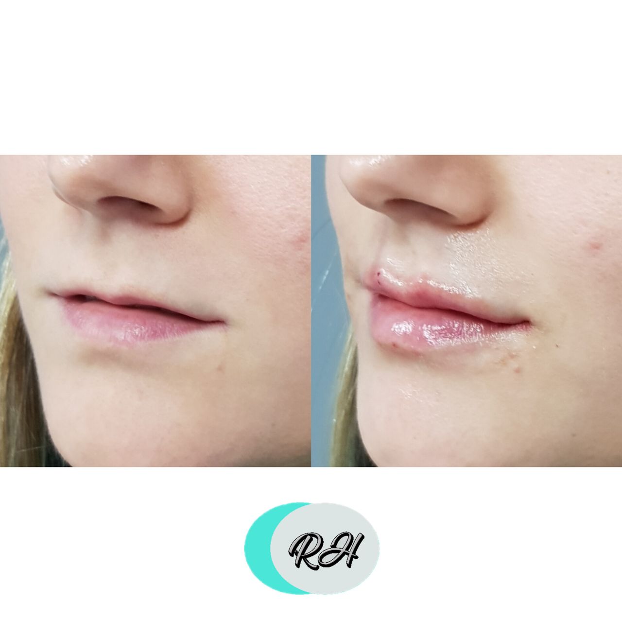 Rosalba Herrero Zerpa-150