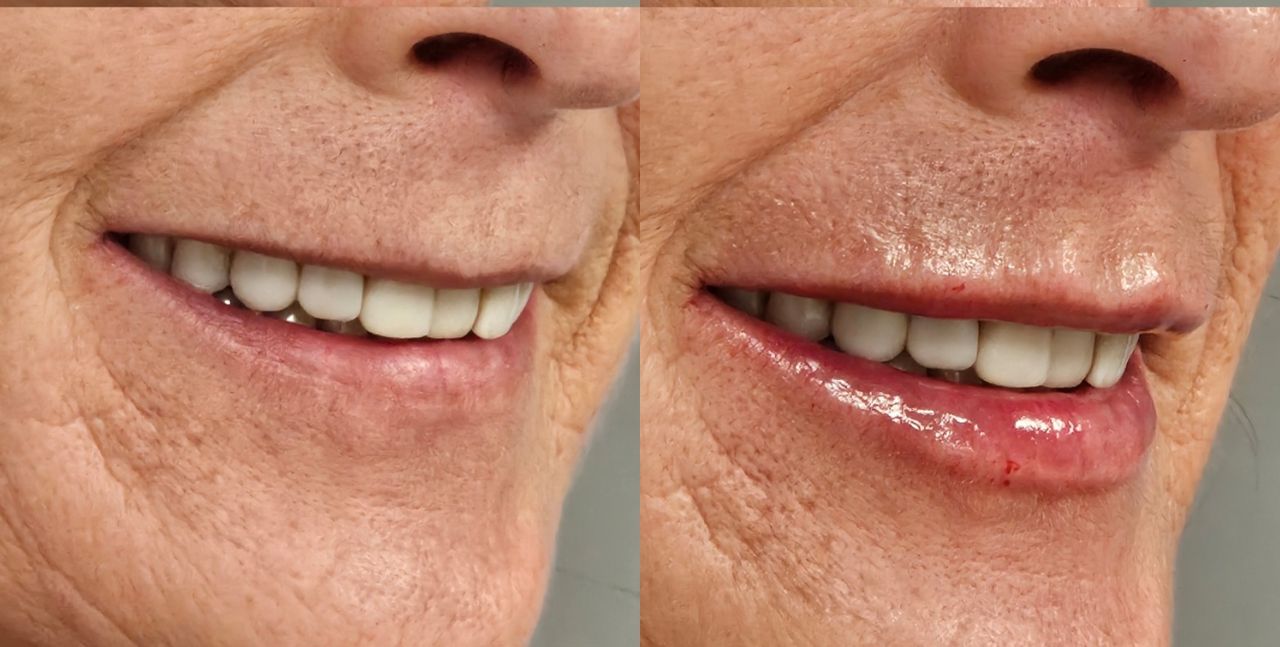 Rosalba Herrero Zerpa-519