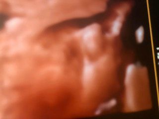 Domenico D'assisi-25