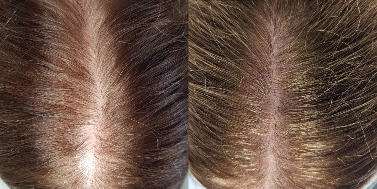 Rosalba Herrero Zerpa-466