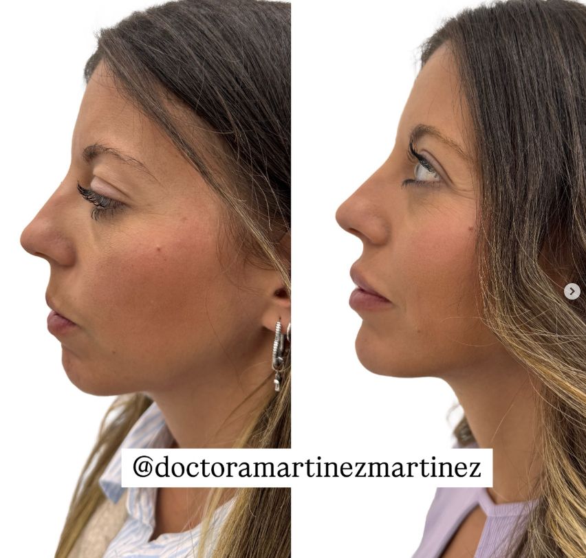 Yesliet Martínez Martínez-3