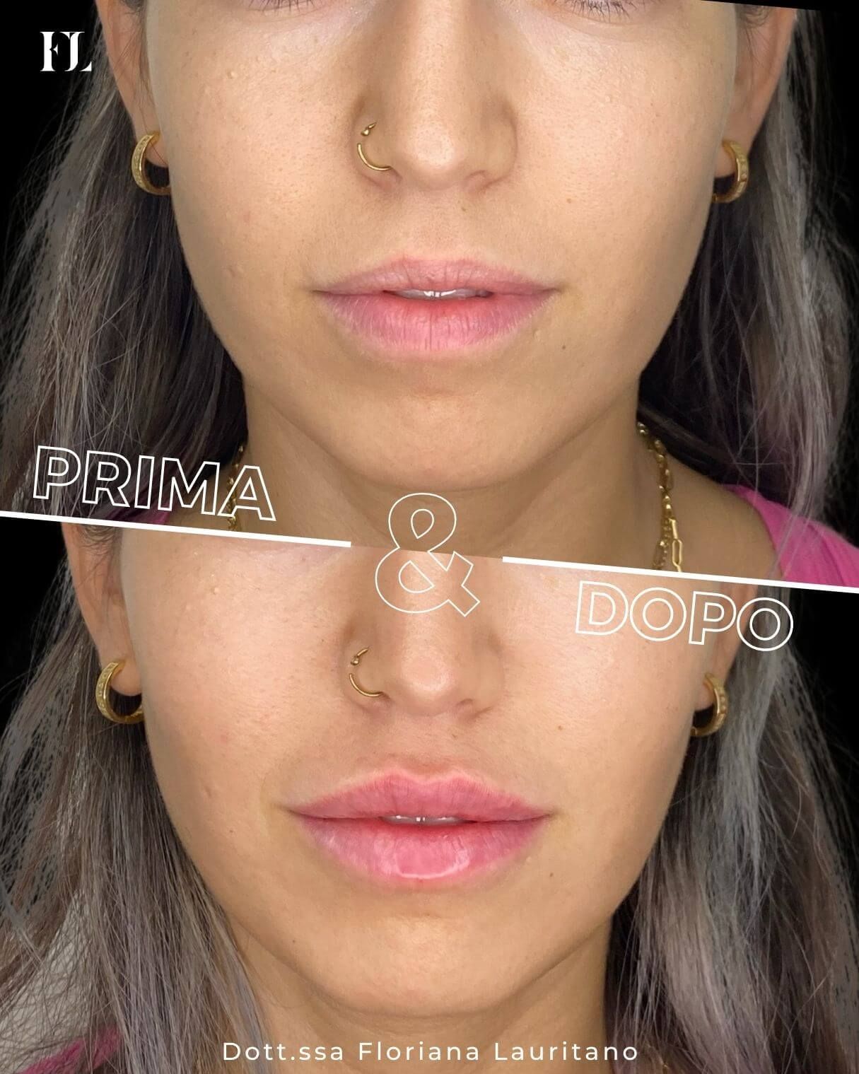 Floriana Lauritano-8