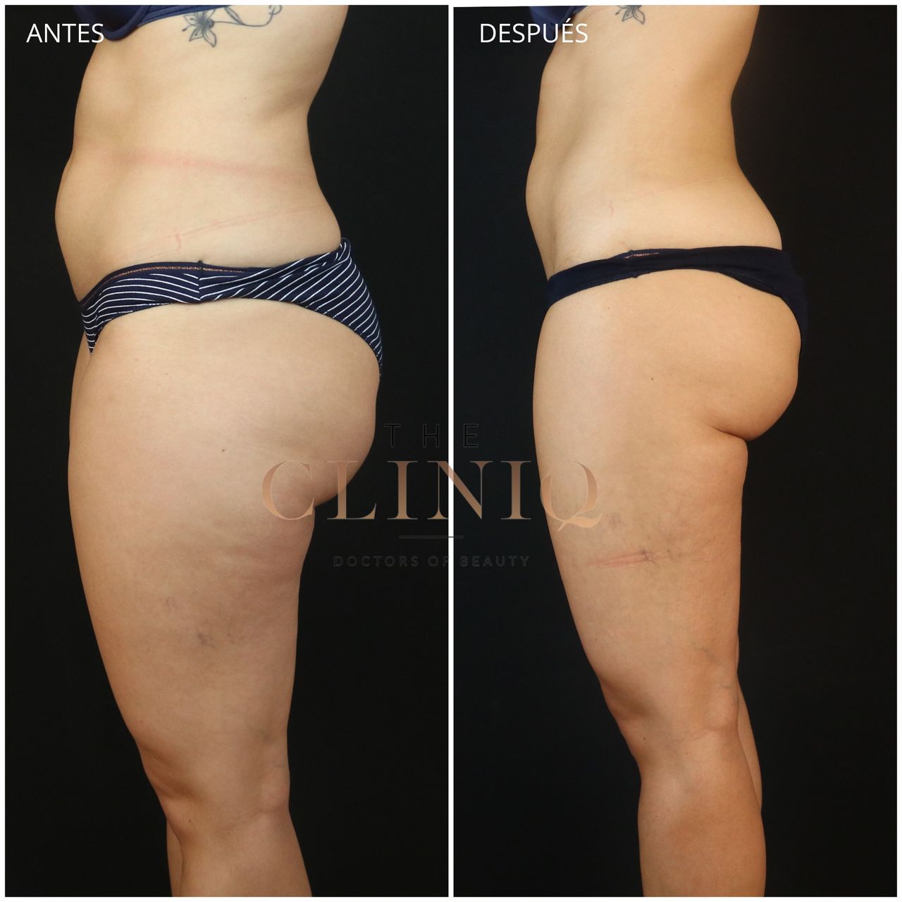 Ricardo Coronel Gagliardi-10