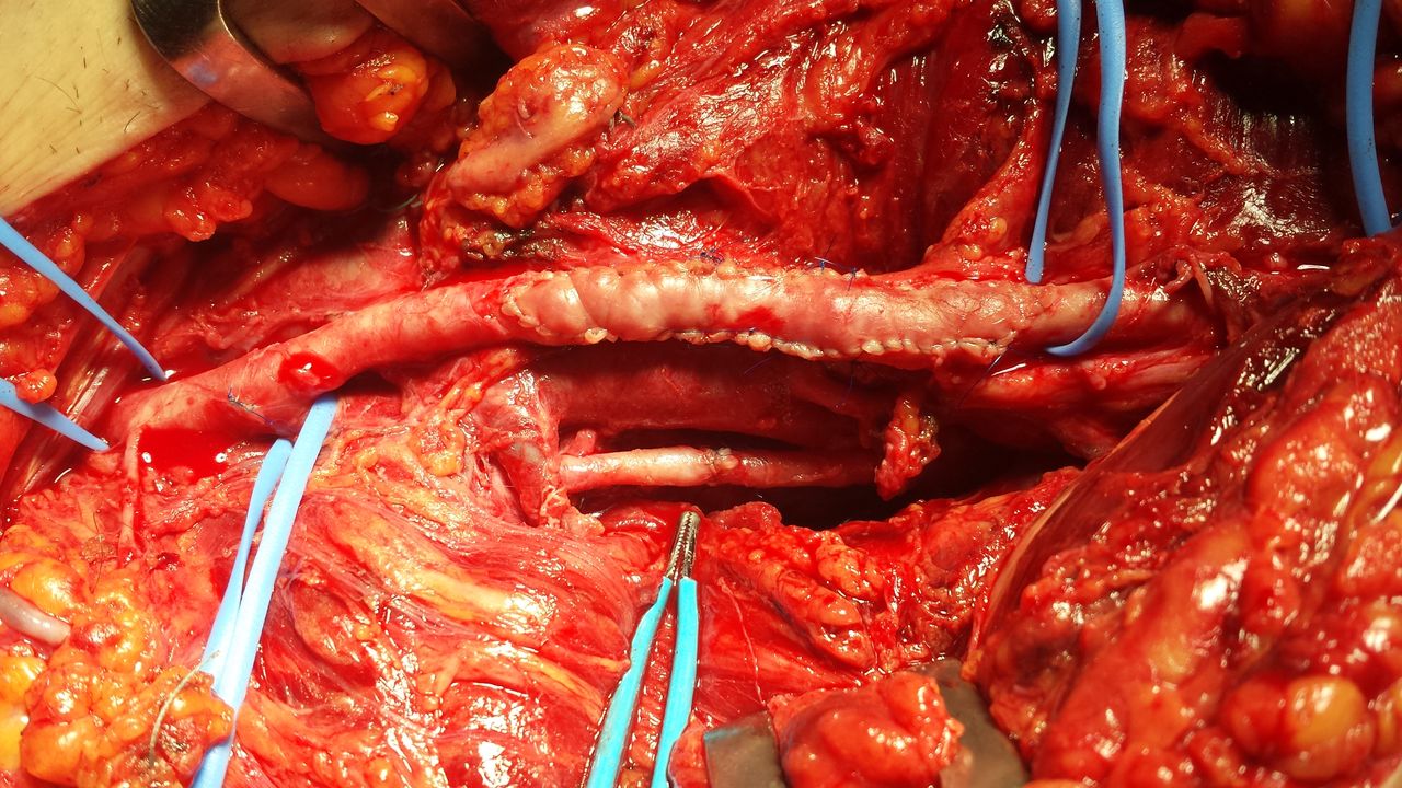 Francesco De Santis-13