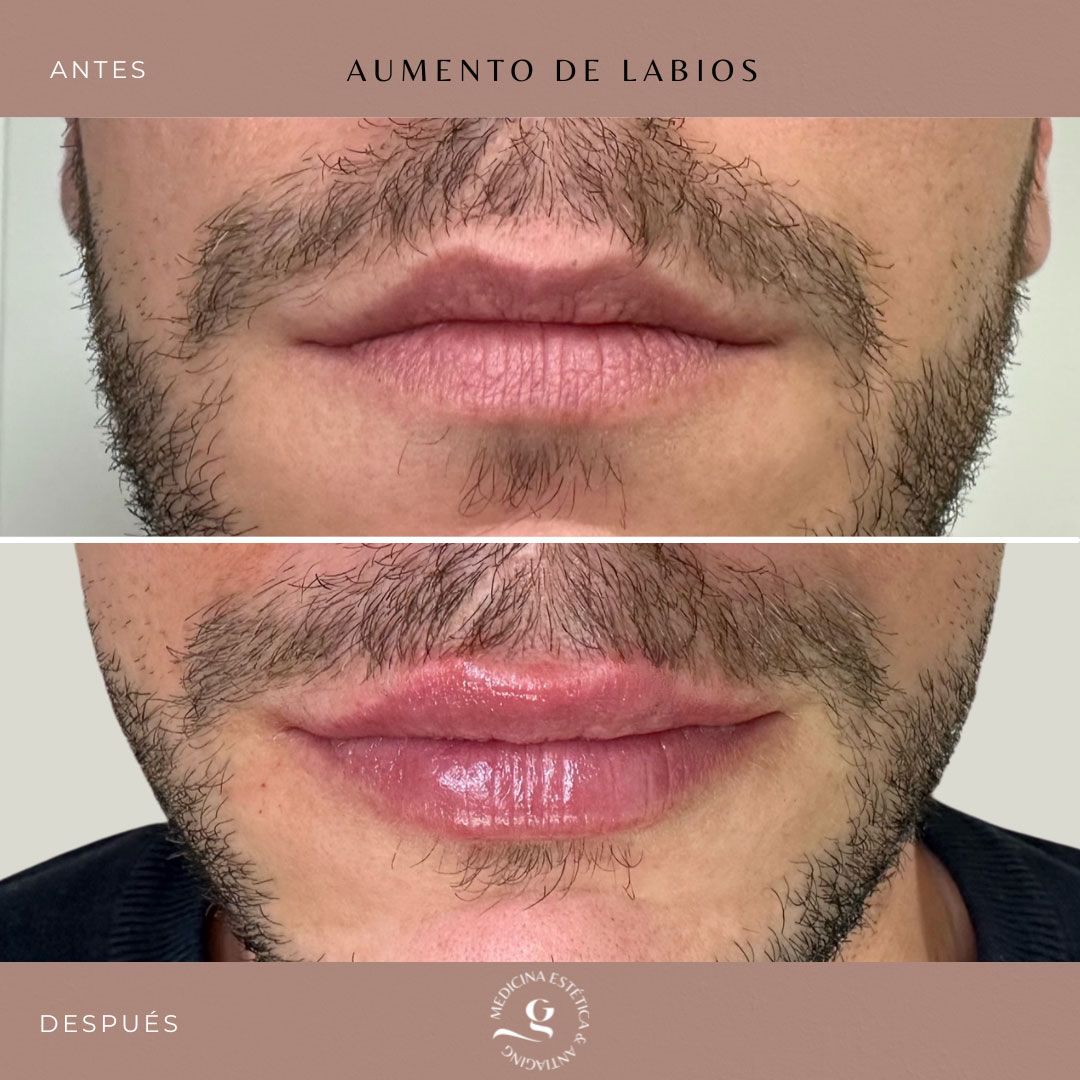 ​Giovanni Giorgianni-14