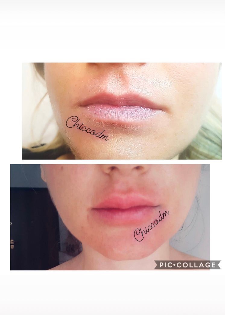 Pasquale Di Molfetta-3