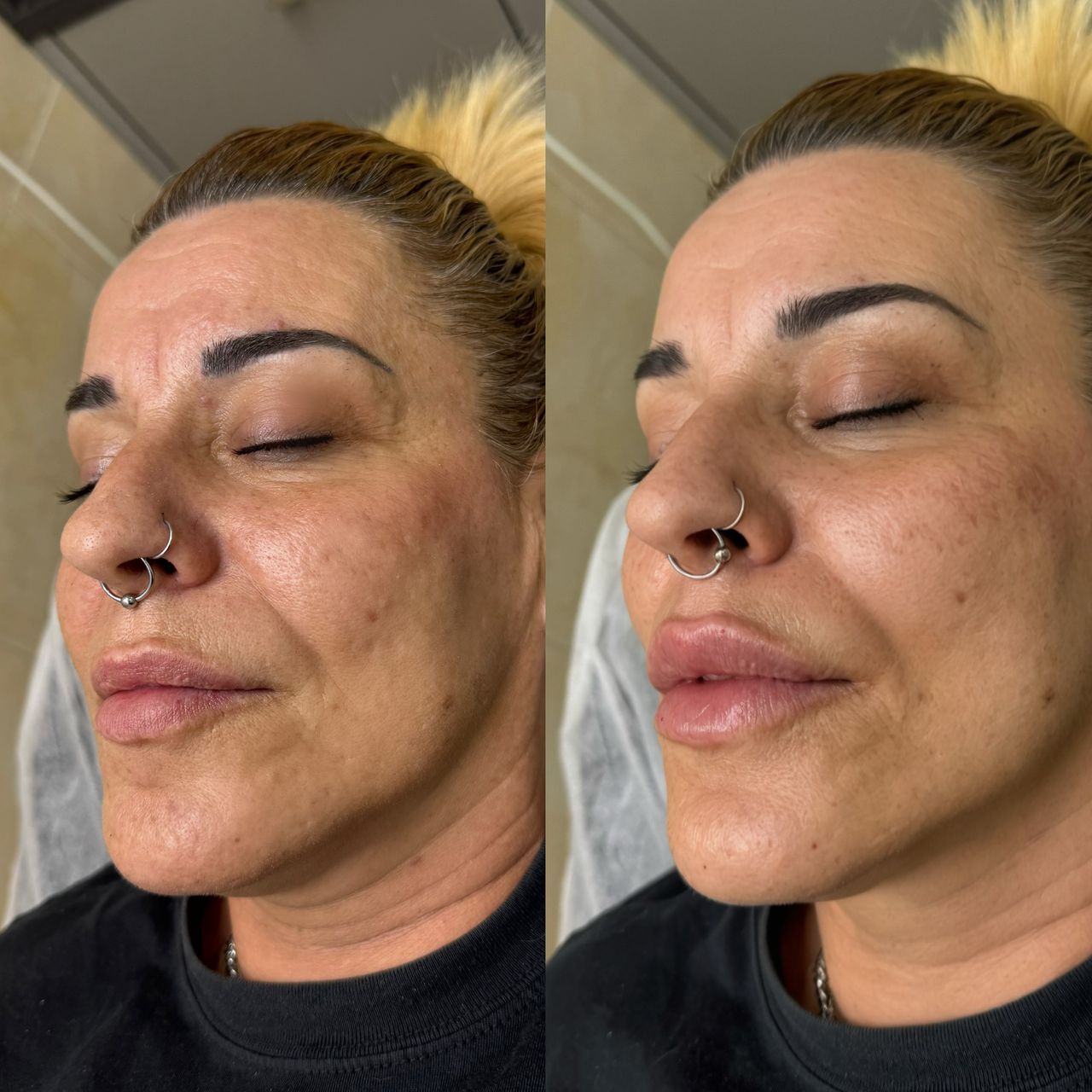 Andrea Catahysa Del Torto-3