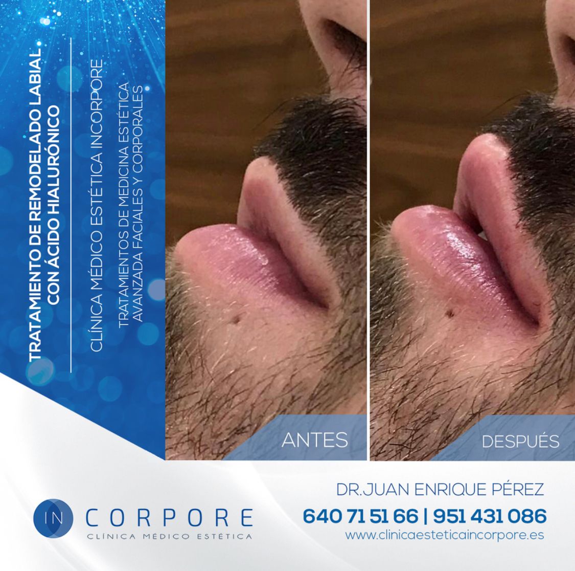 Juan Enrique Pérez Enríquez-115