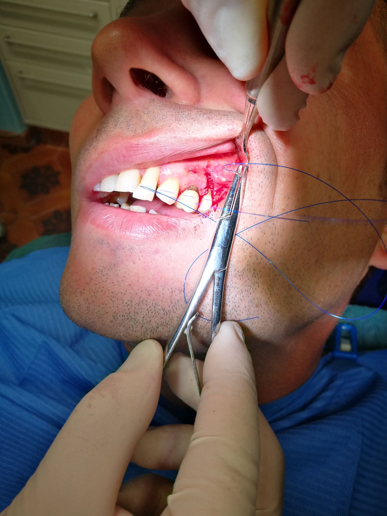 Stefano De Simone-21