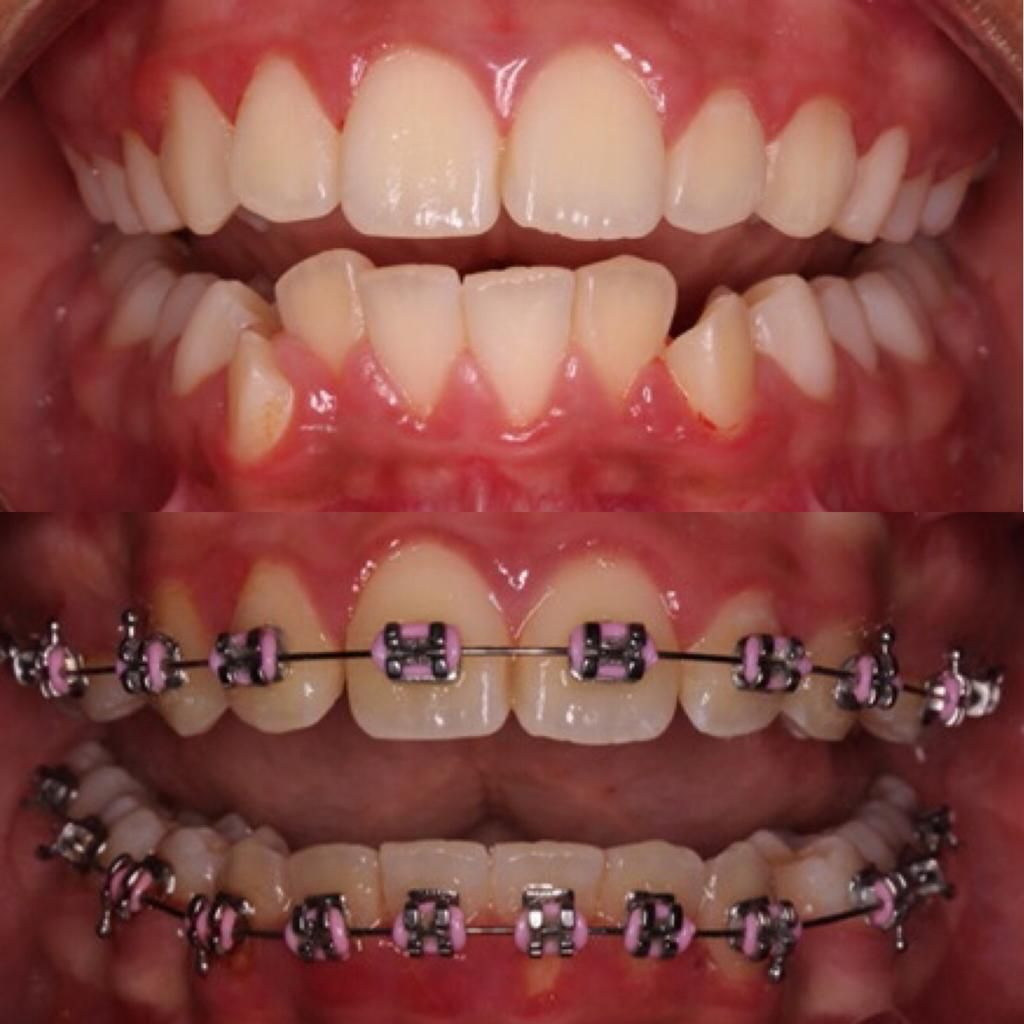 Paula Cano Carrillo-114