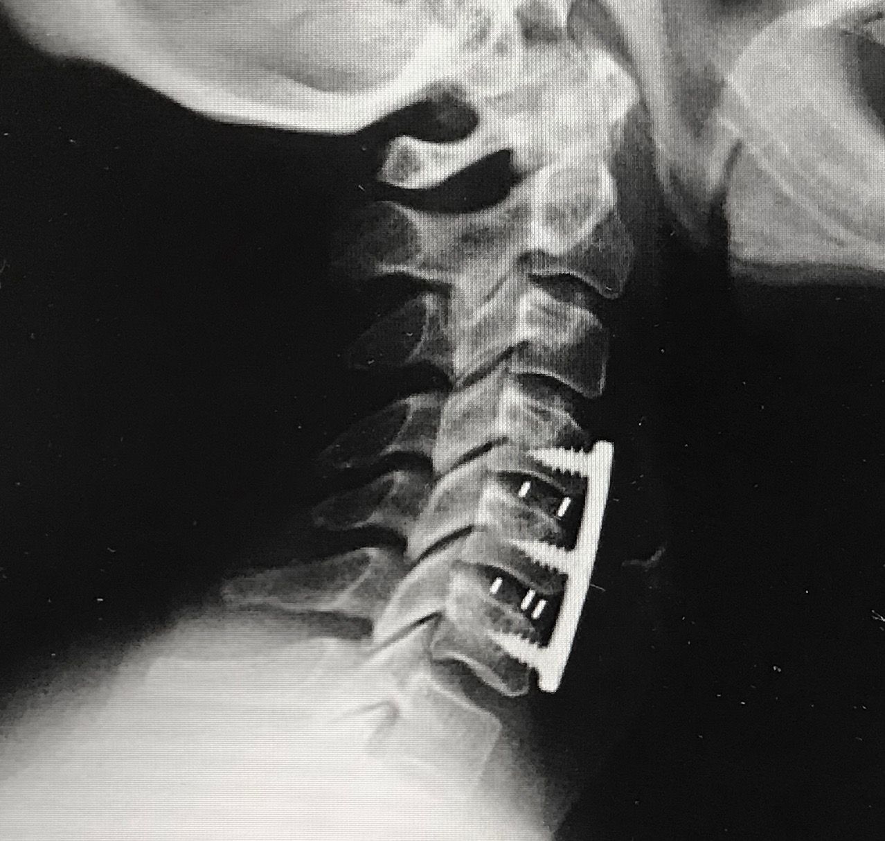 Juan Camilo Hernandez Acevedo-27