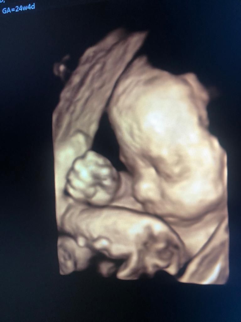 Dilek Turğut Kestane-13