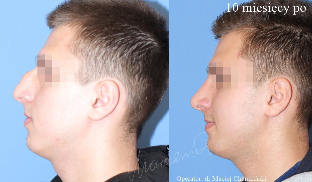 Maciej Charaziński-39