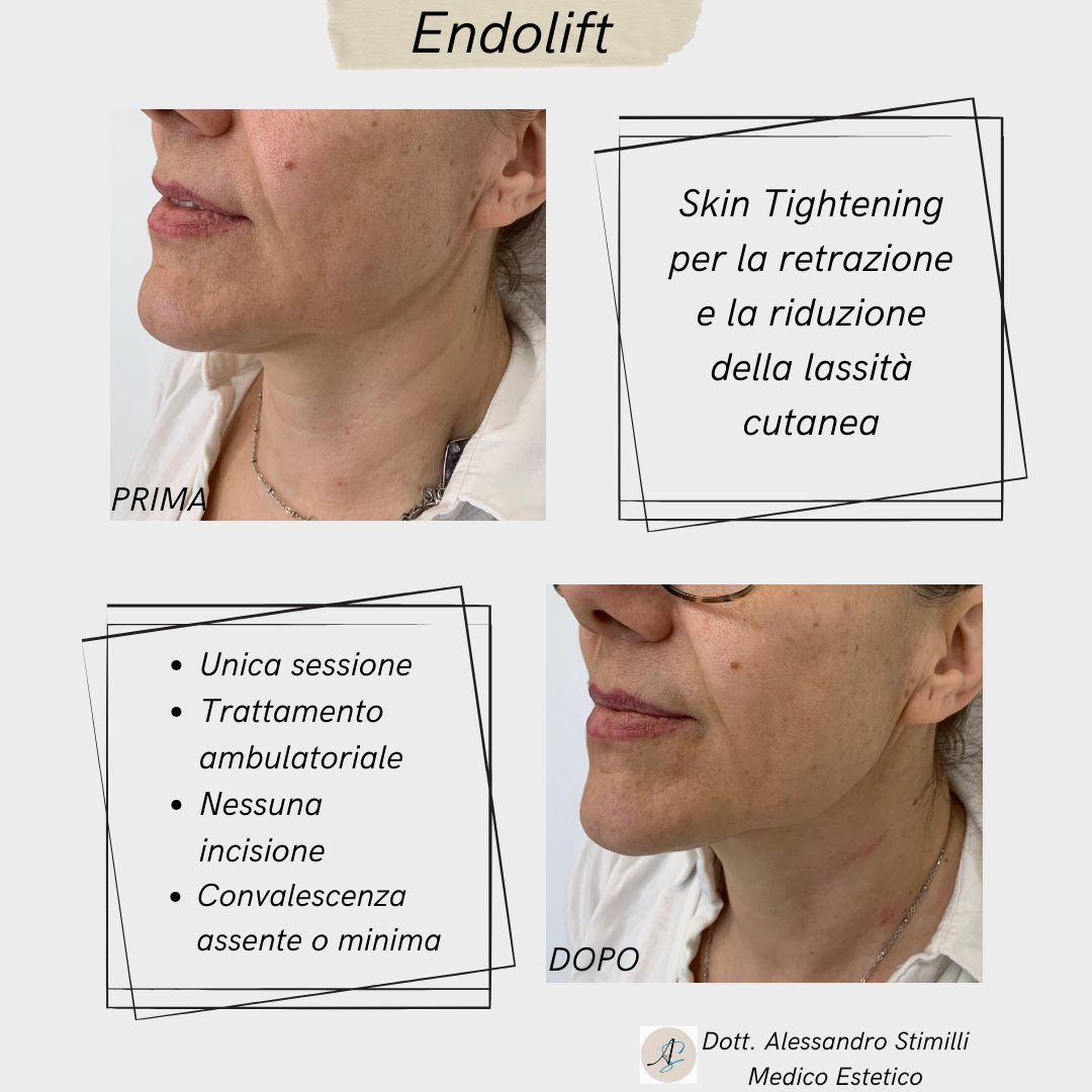 Alessandro Stimilli-3