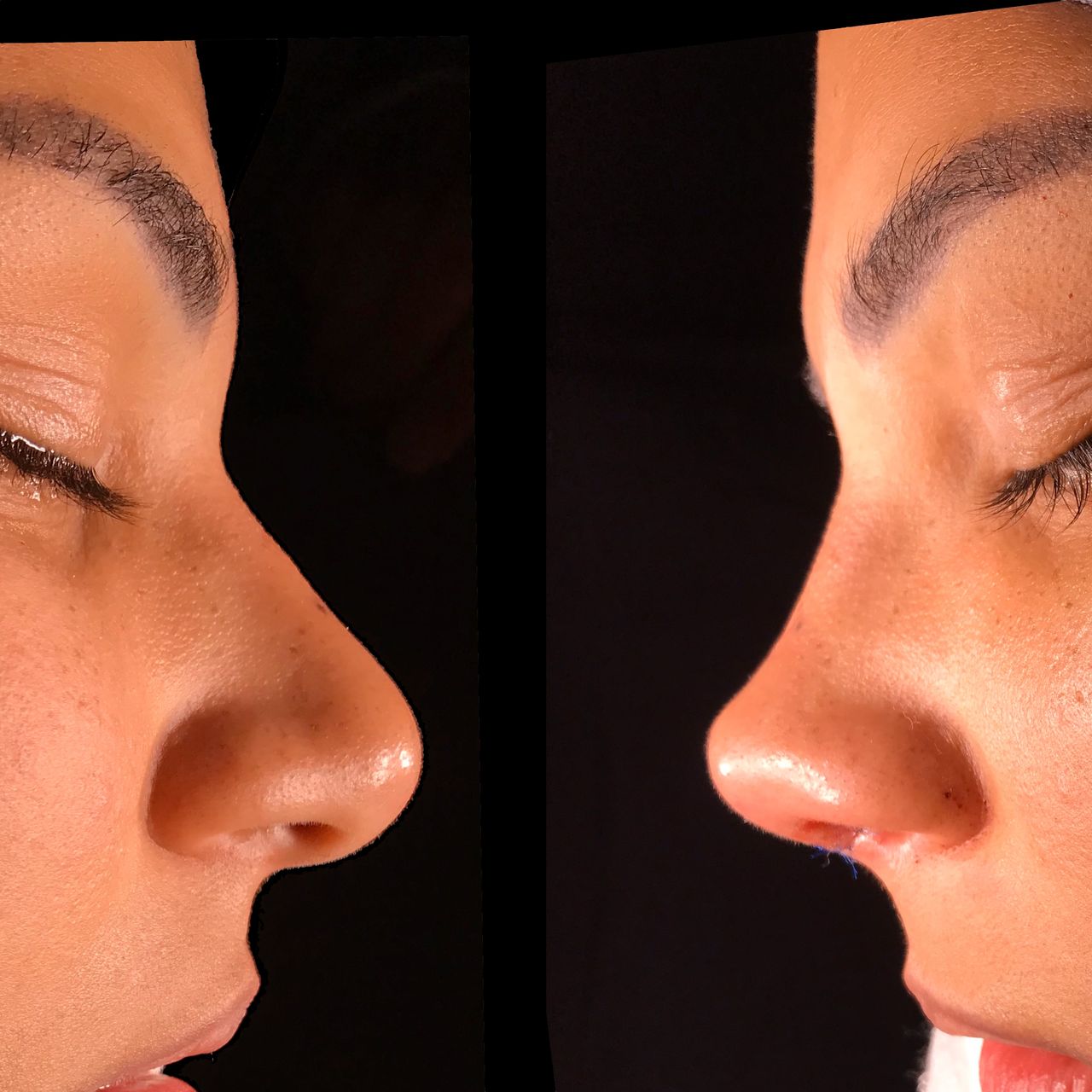 Alvaro Perez Villar-13