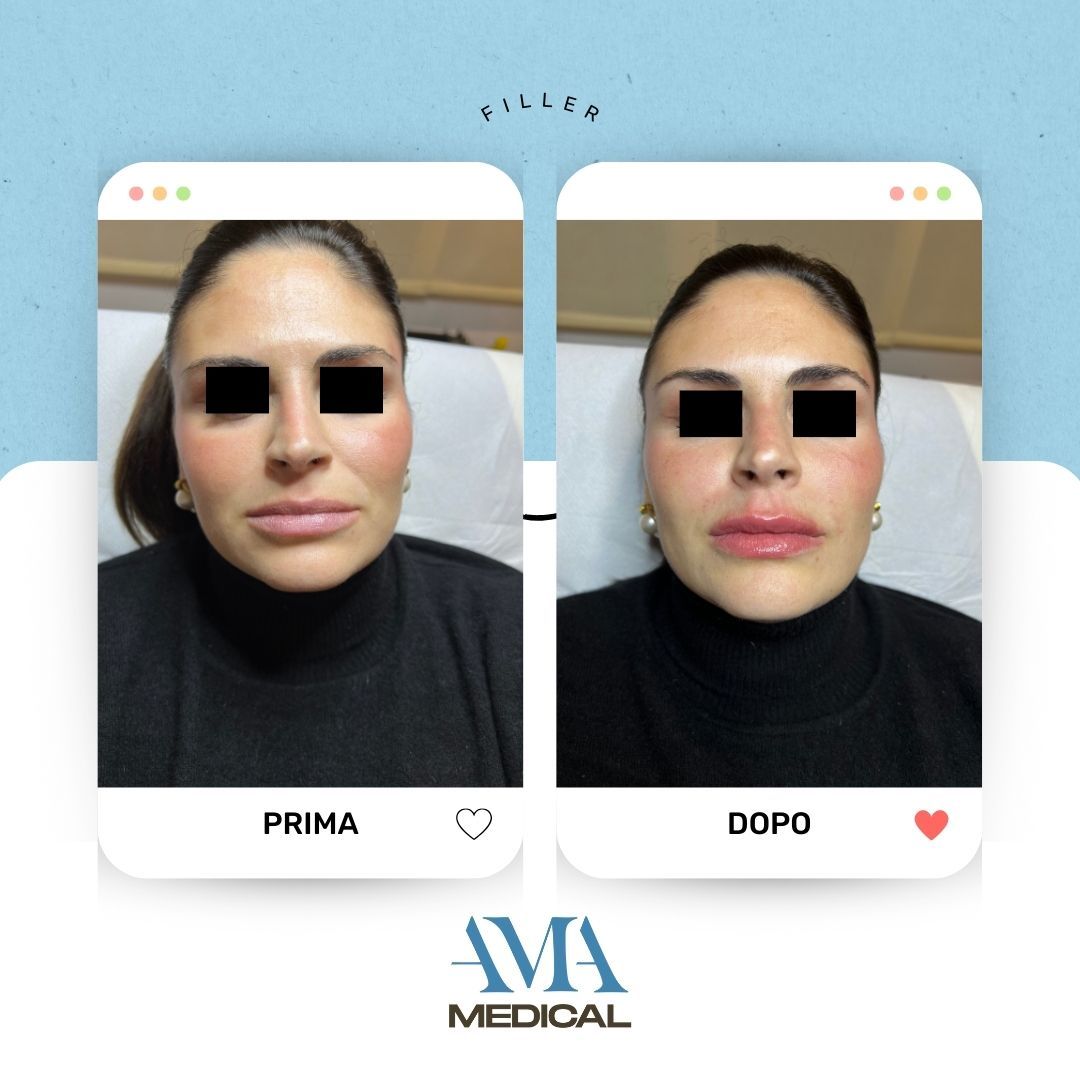 Alessandro Amitrano-0