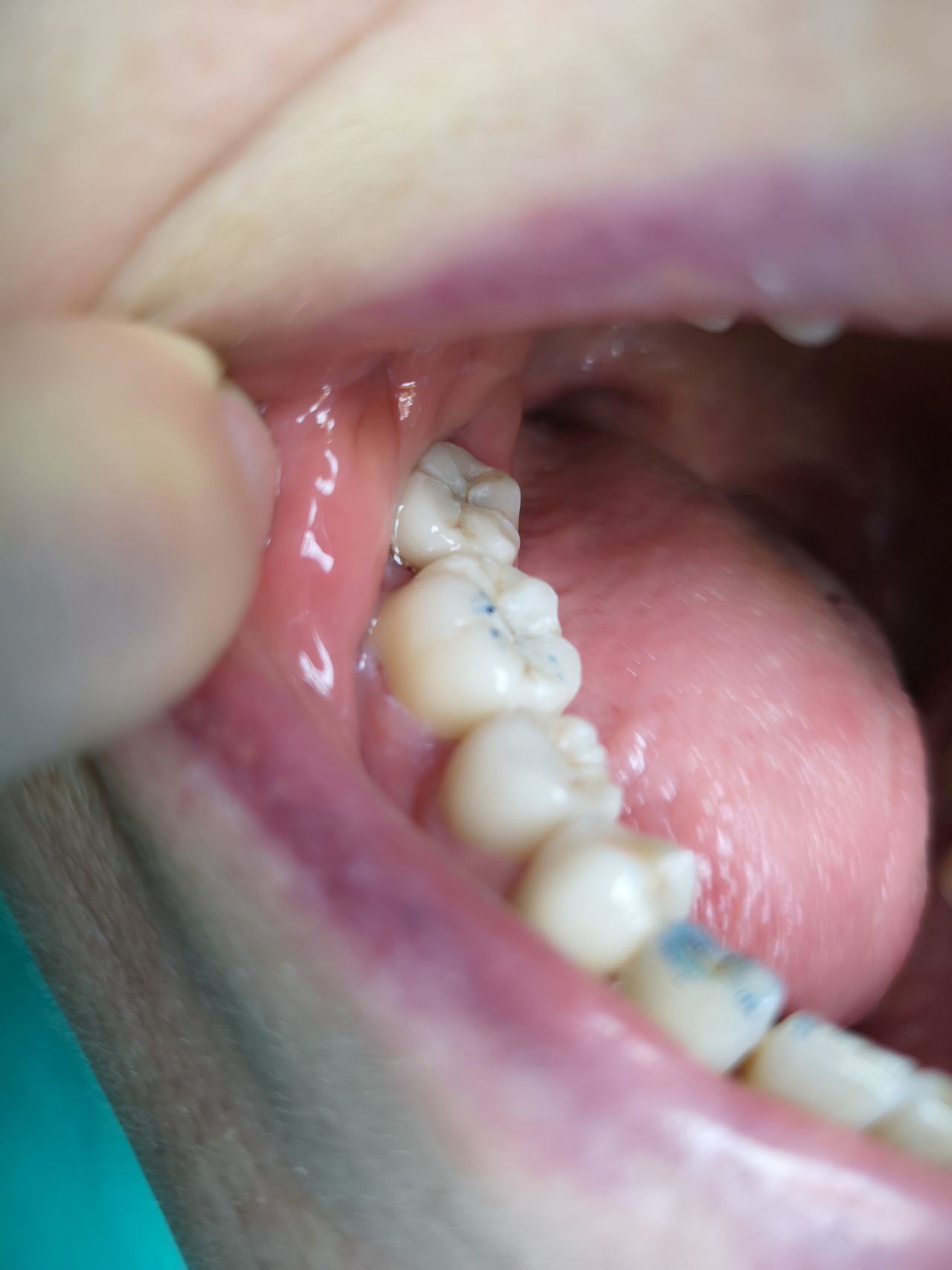 Stefano De Simone-81