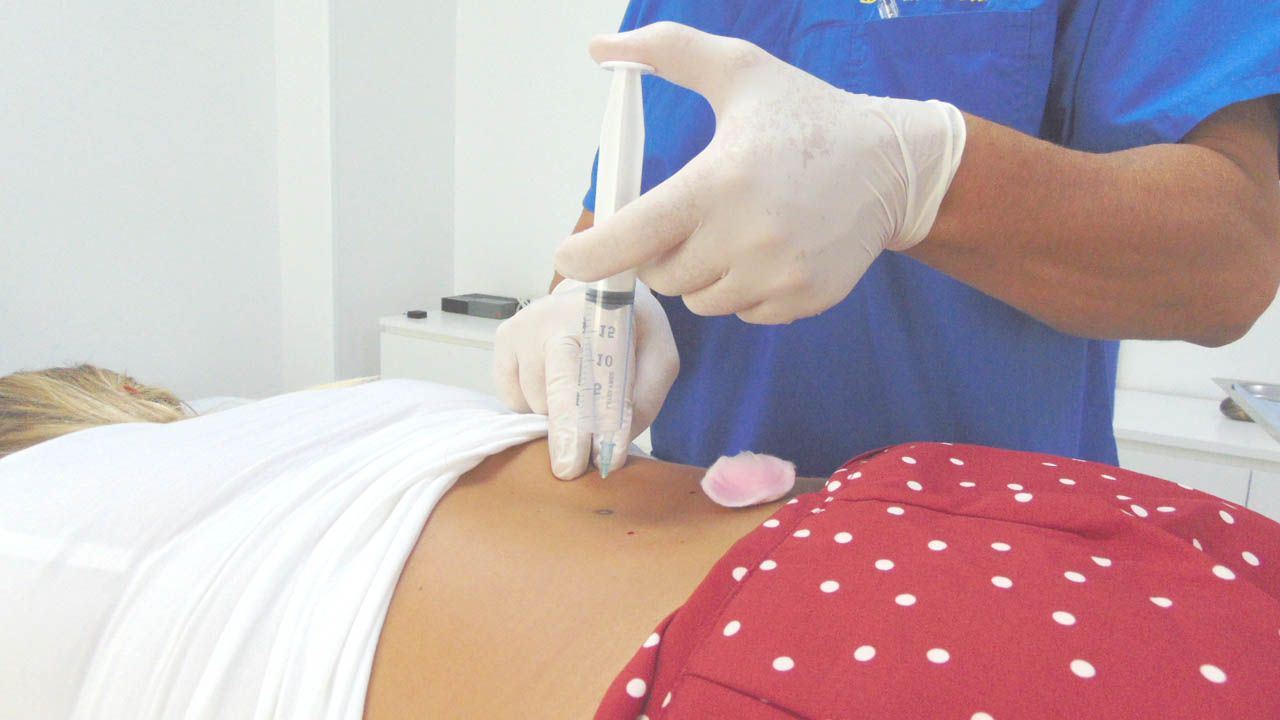 Francesco Cosentino-25