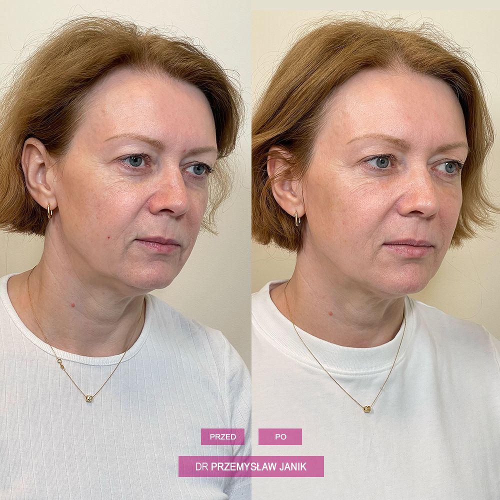 Przemysław Janik-35