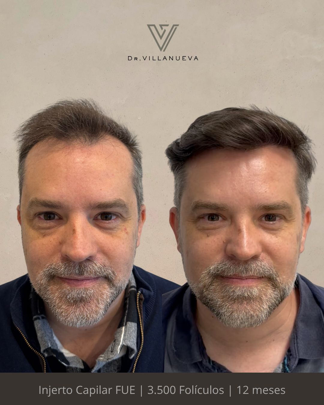Alfredo Villanueva-1
