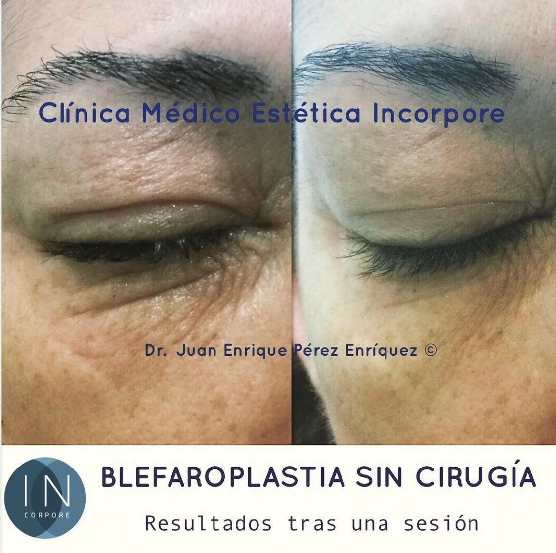 Juan Enrique Pérez Enríquez-85